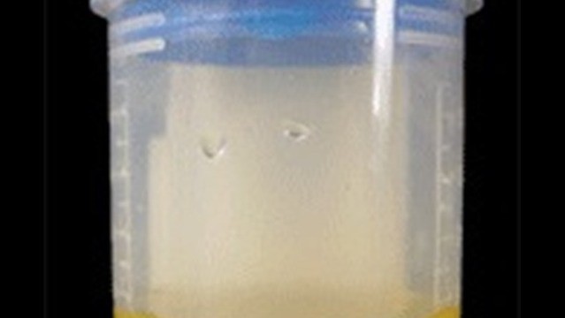 Synthetic 
      Urine Device Bellevue Richmond VA